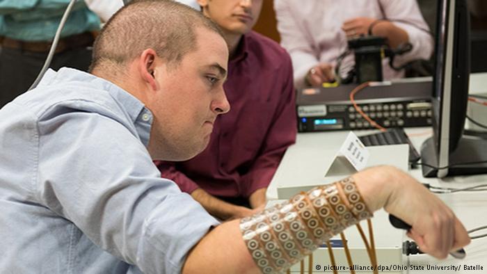 Brain implant helps paralyzed man move hand